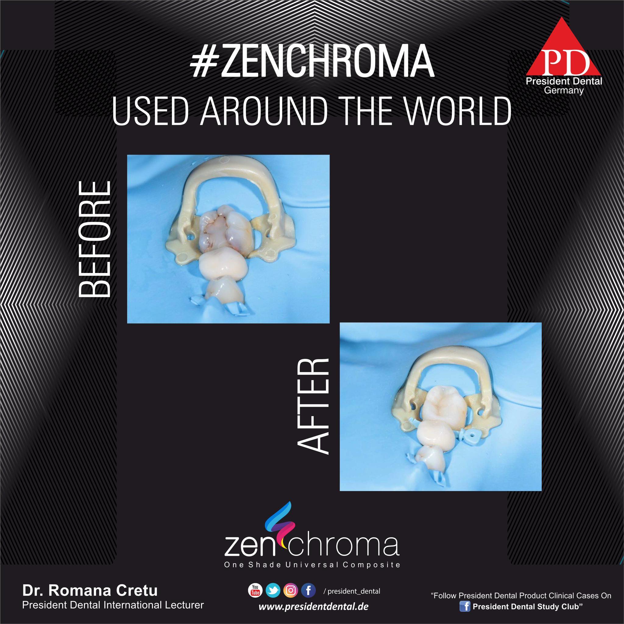 Zenchroma universal